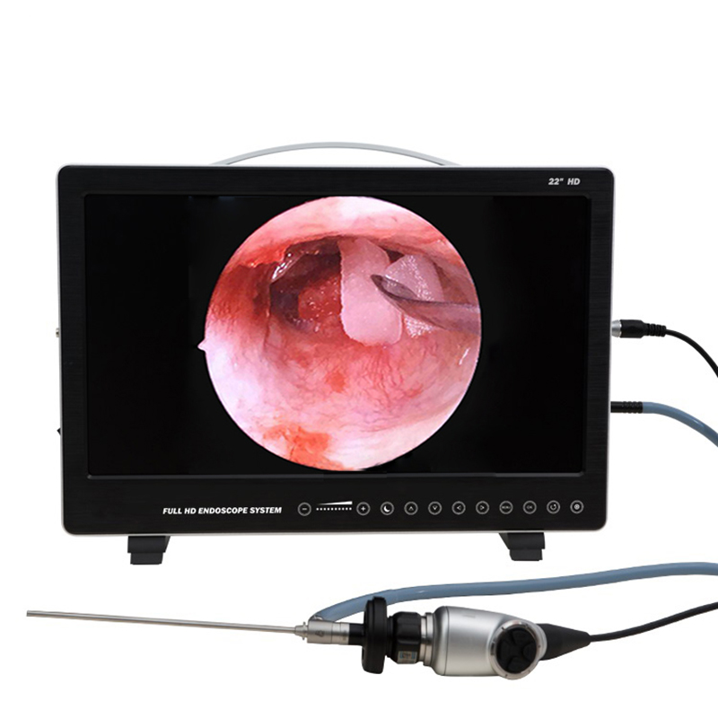 22 Inch Endoscope Camera Syste – обзор и цена Laptop Accessories All In One